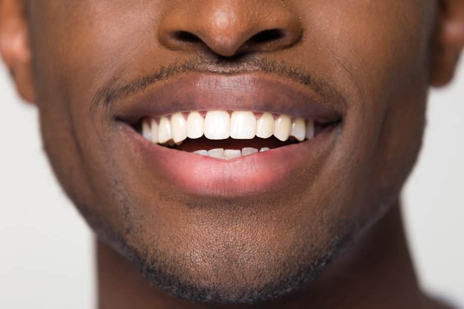 How to Maintain Your ZOOM Whitening Results Through Ontario's Changing Seasons