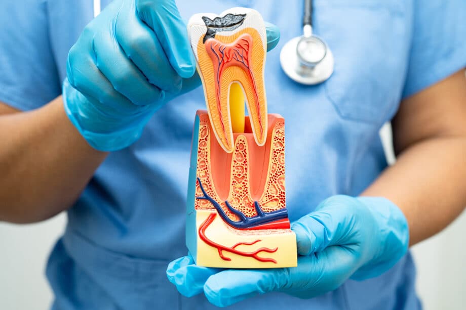 Post-Root Canal Care: Essential Tips for Optimal Healing