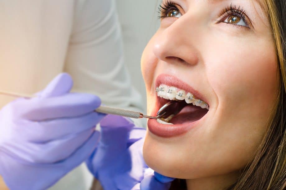 What Is The Ideal Age For Orthodontic Treatment?