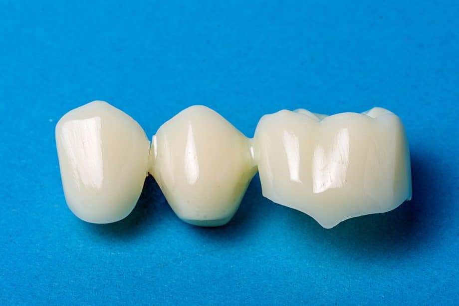 Zirconia vs. Porcelain Crowns: Making the Right Choice for Your Specific Tooth